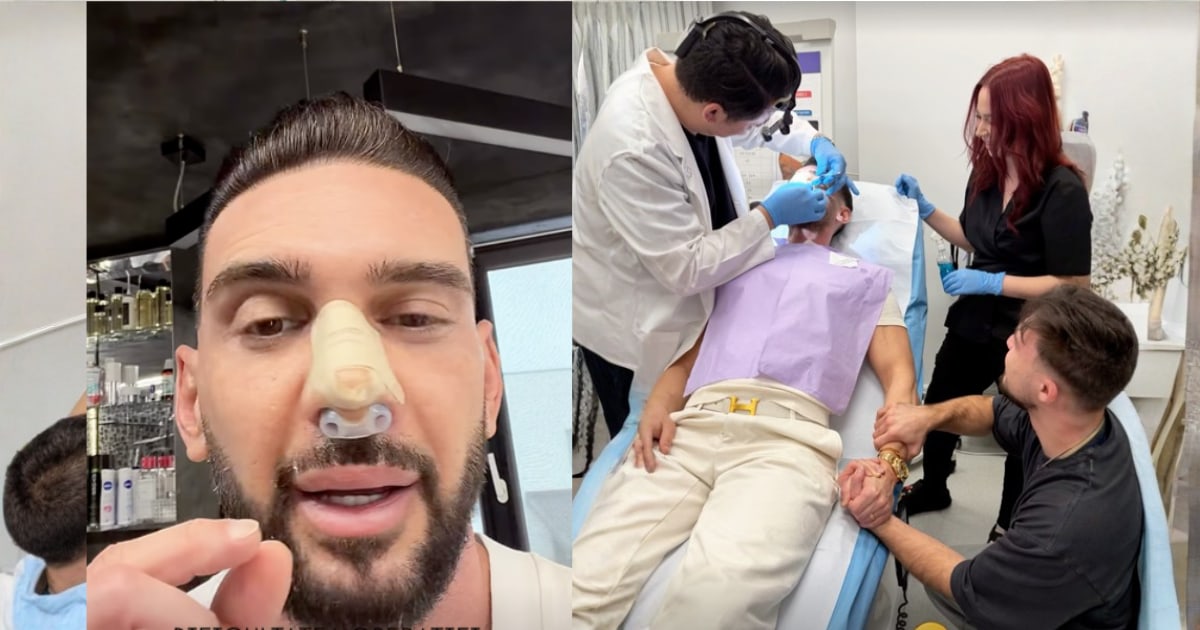 Dorian Popa, după reacțiile la rinoplastie: ce le-a transmis celor care îi comentează nasul