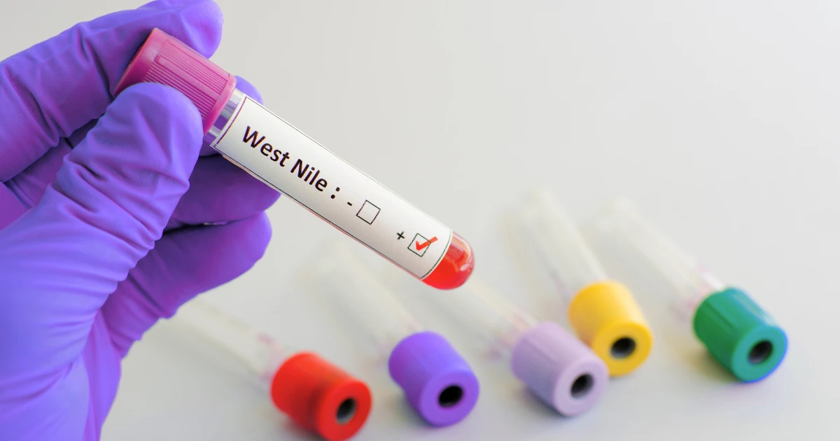 Virusul West Nile în Europa: 12 țări raportează cazuri, iar România are 14 zone afectate (locul 3)