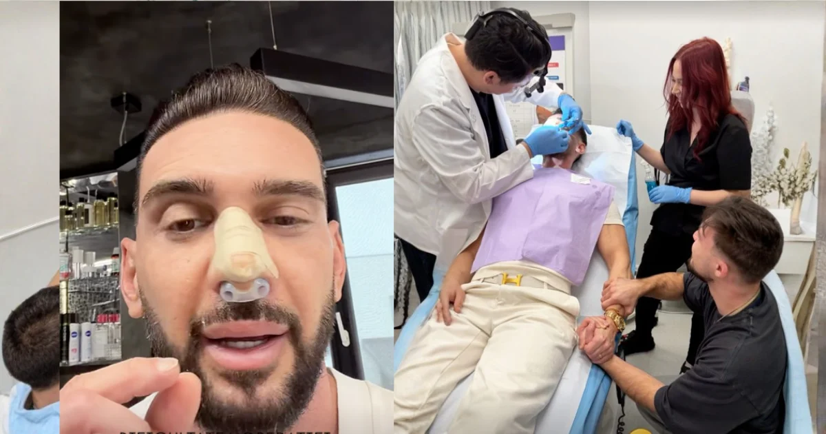 Dorian Popa, după reacțiile la rinoplastie: ce le-a transmis celor care îi comentează nasul