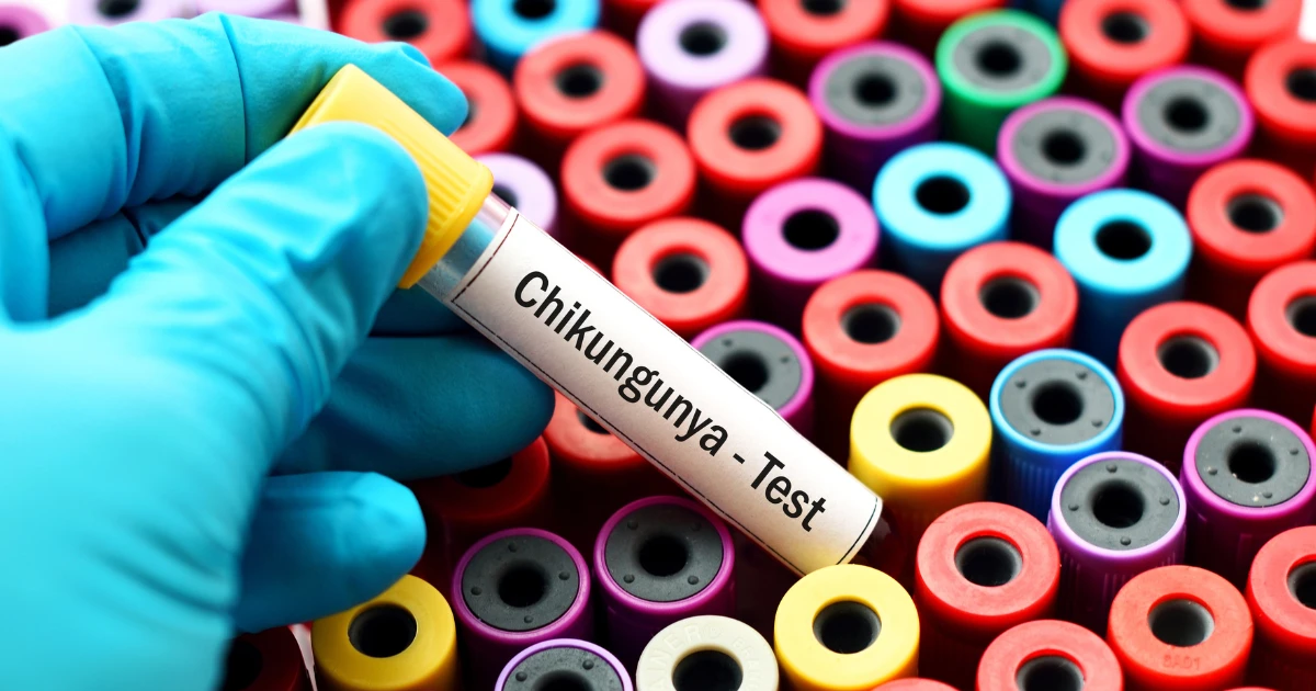 Primul caz de virus Chikungunya confirmat în România: ce recomandă Institutul „Matei Balș” celor care vin din zone de risc